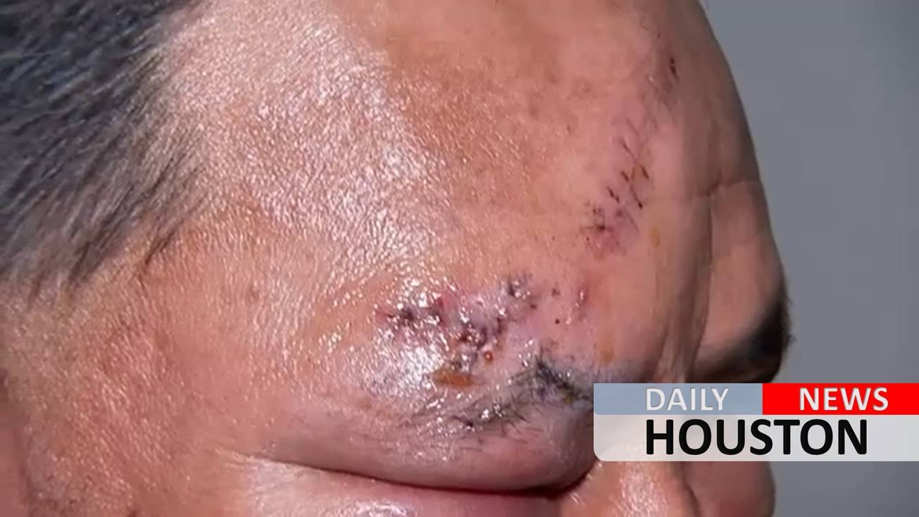 Stabbing spree victim says he was cut in 3 places on his head