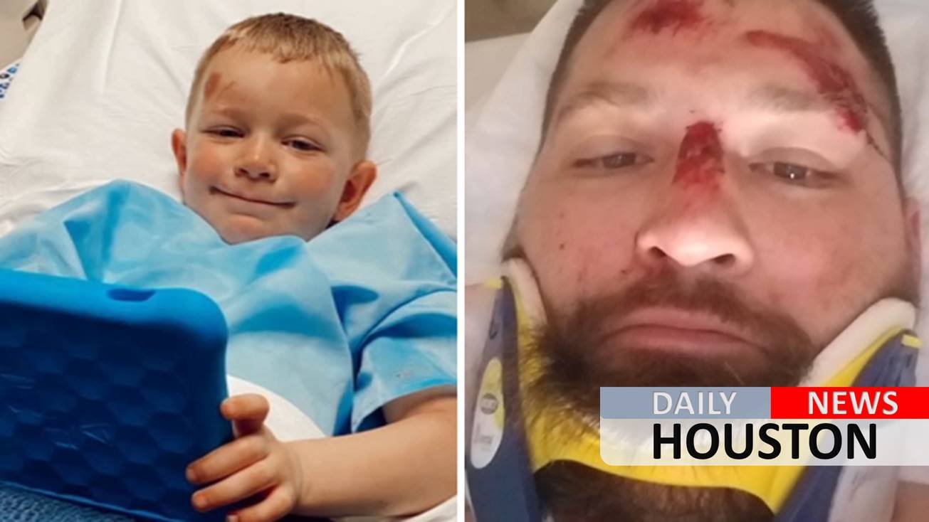 3-year-old Cypress boy lucky to be alive after car impact breaks both of his dad’s legs
