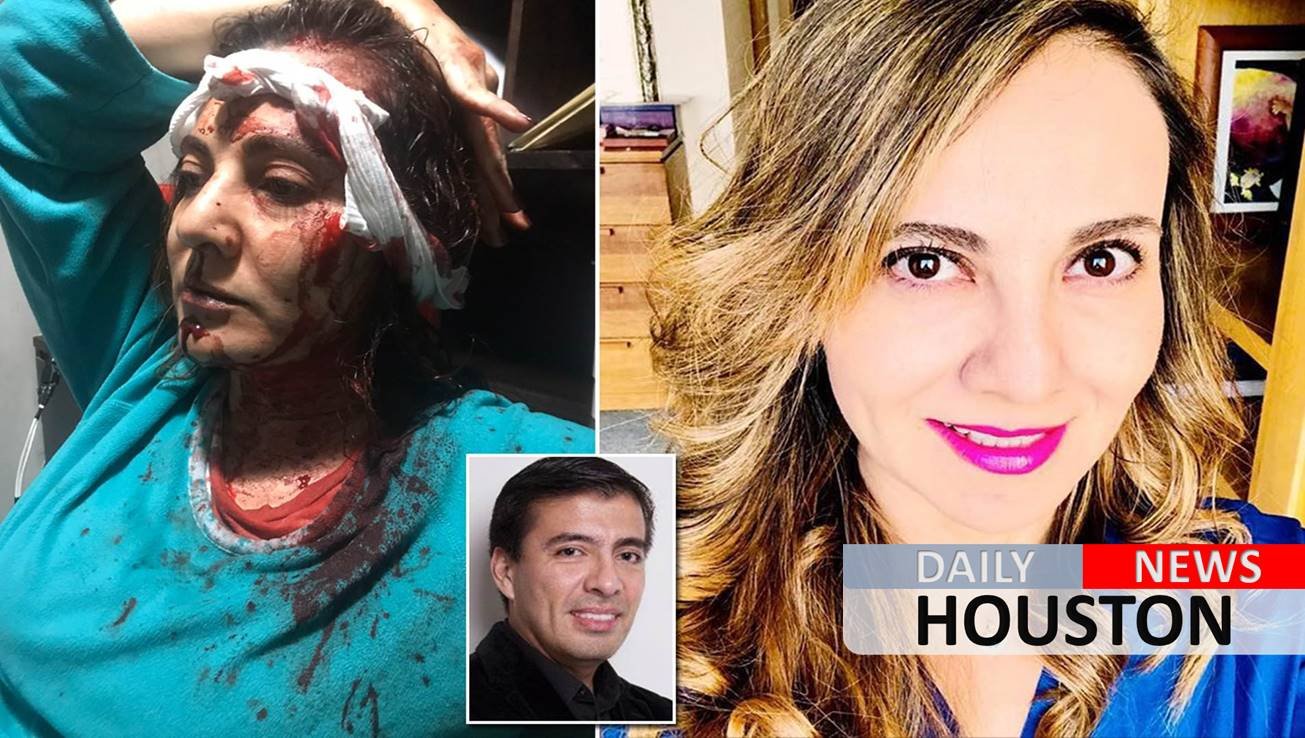 Wife of ex-CEO of Amazon Mexico beaten by husband before murder, images show