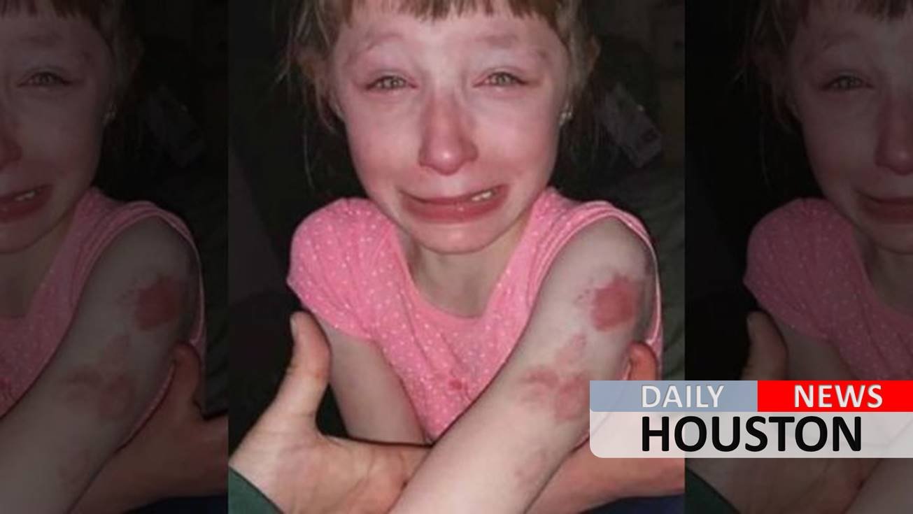 Restrained special-needs student, 10, ‘brutally’ bitten on school bus while driver did nothing