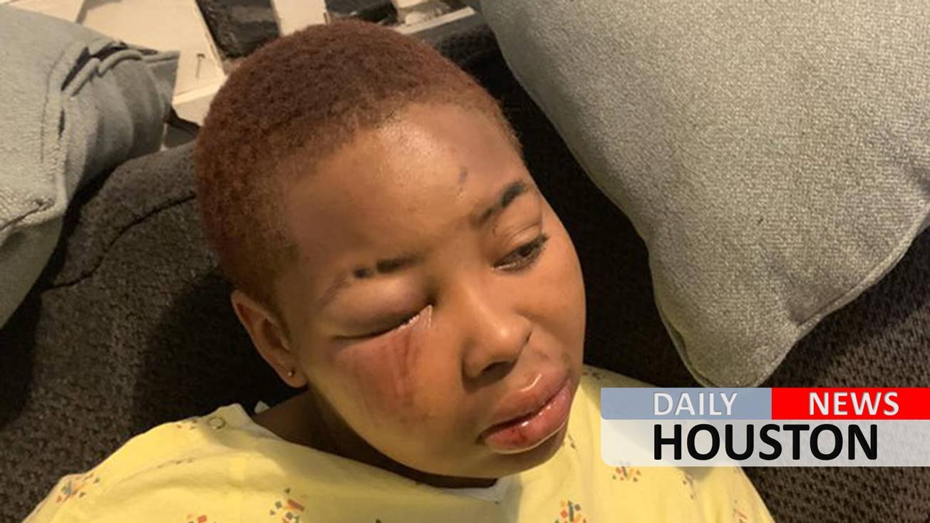 Philadelphia McDonald’s worker ‘hit with brick’, assaulted after refusing to give boys free food, cousin says