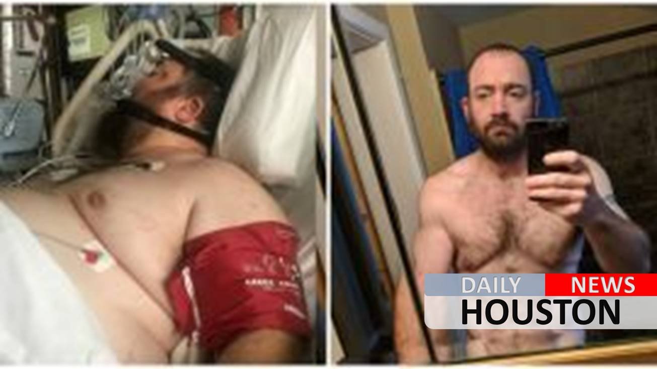 Iowa man sheds half his body weight after invasive spinal surgery, says he once ate ‘with no constraint’