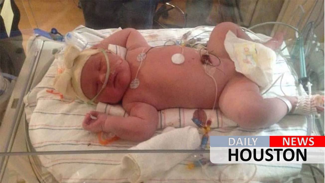 New York mom gives birth to 15-pound baby girl: ‘It was pretty violent’