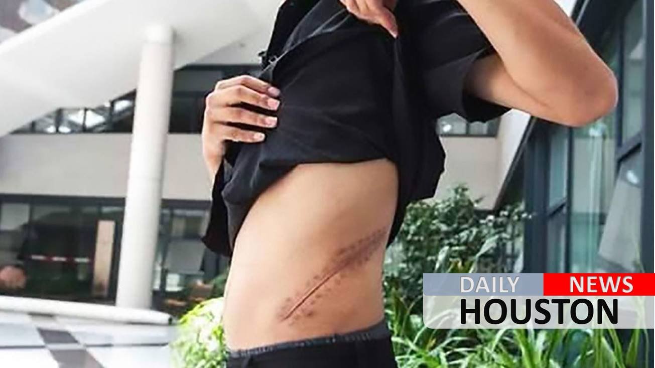 Broke teen who sold kidney for an iPhone now bedridden for life